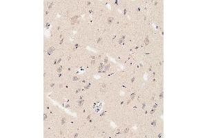Immunohistochemistry (Paraffin-embedded Sections) (IHC (p)) image for anti-delta Like Protein 3 (DLL3) (AA 519-548), (C-Term) antibody (ABIN653276)