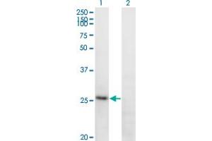 FGA anticorps  (AA 1-218)