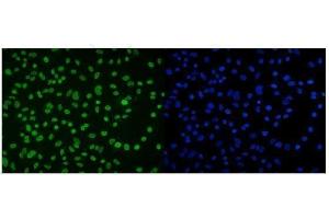 IF analysis of DDX5 using anti-DDX5 antibody (ABIN7602561).