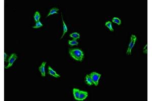 Immunofluorescent analysis of HepG2 cells using ABIN7146648 at dilution of 1:100 and Alexa Fluor 488-congugated AffiniPure Goat Anti-Rabbit IgG(H+L) (CNR2 antibody  (AA 305-360))