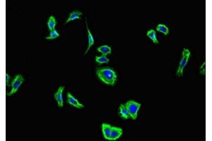 Immunofluorescent analysis of HepG2 cells using ABIN7146648 at dilution of 1:100 and Alexa Fluor 488-congugated AffiniPure Goat Anti-Rabbit IgG(H+L) (CNR2 antibody  (AA 305-360))
