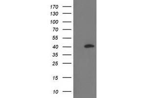 HEK293T cells were transfected with the pCMV6-ENTRY control (Left lane) or pCMV6-ENTRY RLBP1 (Right lane) cDNA for 48 hrs and lysed. (RLBP1 antibody)