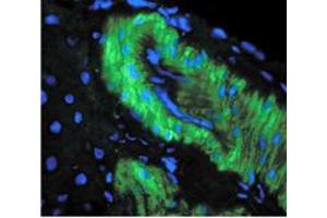 Image no. 1 for anti-Nitrotyrosine antibody (ABIN466935) (Nitrotyrosine antibody)