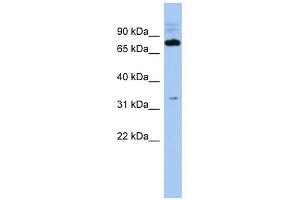 C14ORF44 antibody used at 1 ug/ml to detect target protein. (FAM161B antibody  (Middle Region))