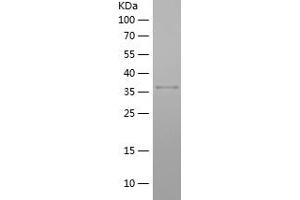 HNRNPA3 Protein (AA 210-345) (His-IF2DI Tag)