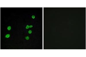 Immunofluorescence analysis of MCF7 cells, using p97 MAPK Antibody.