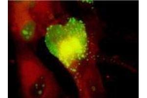 ELISA image for anti-Cytomegalovirus p65 (CMV p65) antibody (ABIN265536) (CMV p65 antibody)