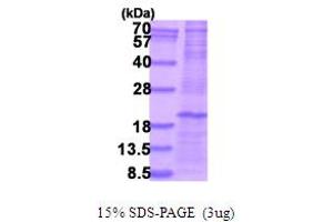 SDS-PAGE (SDS) image for C-Type Lectin Domain Family 5, Member A (CLEC5A) (AA 28-188) protein (His tag) (ABIN5854053) (CLEC5A Protein (AA 28-188) (His tag))
