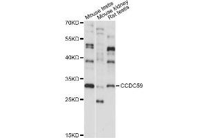 Western blot analysis of extracts of various cell lines, using CCDC59 antibody (ABIN6293275) at 1:1000 dilution. (CCDC59 antibody)