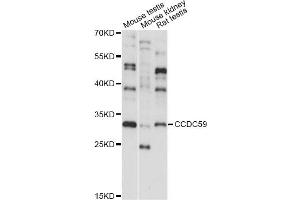 Western blot analysis of extracts of various cell lines, using CCDC59 antibody (ABIN6293275) at 1:1000 dilution.