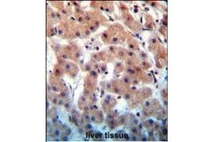 INHBB Antibody (C-term) (ABIN655083 and ABIN2844717) immunohistochemistry analysis in formalin fixed and paraffin embedded human liver tissue followed by peroxidase conjugation of the secondary antibody and DAB staining. (INHBB antibody  (C-Term))