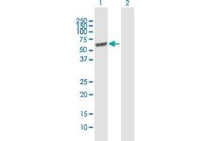 Western Blot analysis of LGI1 expression in transfected 293T cell line by LGI1 MaxPab polyclonal antibody. (LGI1 antibody  (AA 1-557))