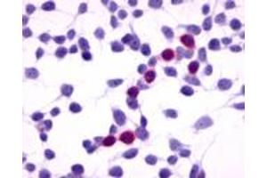 Anti-GPRC5A / RAI3 antibody immunocytochemistry (ICC) staining of HEK293 human embryonic kidney cells transfected with GPRC5A / RAI3.