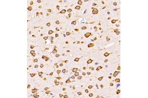 Immunohistochemistry (Paraffin-embedded Sections) (IHC (p)) image for anti-Chloride Intracellular Channel 6 (CLIC6) antibody (ABIN7073478)