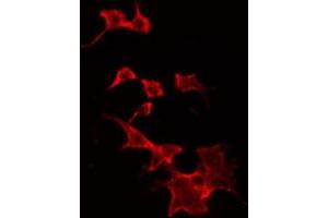 ABIN6268960 staining Hela by IF/ICC. (Stathmin 1 antibody  (N-Term))