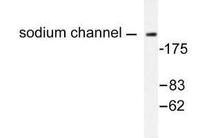 Image no. 1 for anti-Na+ Channel Protein antibody (ABIN271819) (Na+ Channel Protein antibody)