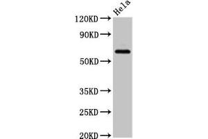 Western Blot Positive WB detected in: Hela whole cell lysate All lanes: SLC22A25 antibody at 6. (SLC22A25 antibody  (AA 31-145))
