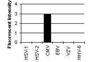 Cross Reactivity Results determined by IFA (ICP22 Delayed Early Protein (CMV ICP22) antibody)