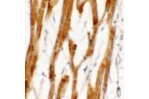 Immunohistochemistry of FCHO2 in human heart tissue with FCHO2 antibody Cat-. (FCHO2 antibody  (Middle Region))