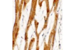 Immunohistochemistry of FCHO2 in human heart tissue with FCHO2 antibody Cat-.