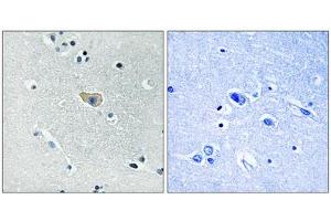 NMDAR1 (Phospho-Ser890) antibody reacts with epitope-specific phosphopeptide and corresponding non-phosphopeptide. (GRIN1/NMDAR1 antibody  (pSer890))