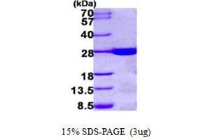 SDS-PAGE (SDS) image for Haloacid Dehalogenase-Like Hydrolase Domain Containing 1 (HDHD1) (AA 1-228) protein (His tag) (ABIN667274) (HDHD1 Protein (AA 1-228) (His tag))
