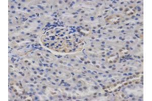 Immunohistochemistry (IHC) image for anti-Calcium/calmodulin-Dependent serine Protein Kinase (MAGUK Family) (CASK) antibody (ABIN1871447) (CASK antibody)