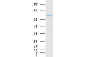 Western Blotting (WB) image for Junction Plakoglobin (JUP) (Transcript Variant 1) protein (Myc-DYKDDDDK Tag) (ABIN2723948)