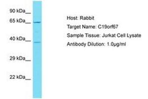 Image no. 1 for anti-Chromosome 19 Open Reading Frame 67 (C19ORF67) (AA 76-125) antibody (ABIN6750821) (C19ORF67 antibody  (AA 76-125))