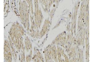 ABIN6274651 at 1/100 staining Mouse muscle tissue by IHC-P. (CYP2R1 antibody  (Internal Region))