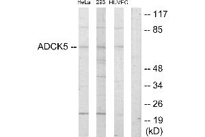 Western blot analysis of extracts from HeLa cells, 293 cells and HUVEC cells, using ADCK5 antibody. (ADCK5 antibody  (Internal Region))