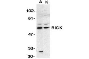 Image no. 1 for anti-Receptor-Interacting Serine-threonine Kinase 2 (RIPK2) (N-Term) antibody (ABIN318972)