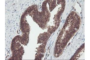Image no. 2 for anti-CNDP Dipeptidase 2 (Metallopeptidase M20 Family) (CNDP2) antibody (ABIN1497548) (CNDP2 antibody)
