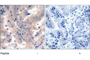 Image no. 1 for anti-Phosphoinositide 3 Kinase, p85 alpha (PI3K p85a) (pTyr199), (pTyr464), (pTyr467) antibody (ABIN401567) (PIK3R1 antibody  (pTyr199, pTyr464, pTyr467))