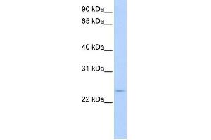 CIP29 antibody used at 0. (SARNP antibody  (C-Term))