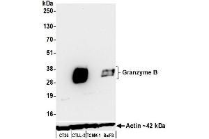 Western Blotting (WB) image for anti-Granzyme B (GZMB) (C-Term) antibody (ABIN7795632)