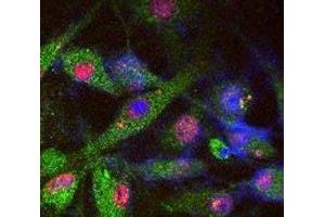SY5Y cells stained for endogenous PARK8 (green), phosphorylated Tau (red), and DAPI nuclear staining. (LRRK2 antibody  (AA 930-961))