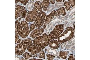 Immunohistochemical staining of human kidney with URB2 polyclonal antibody  shows strong cytoplasmic positivity in cells in tubules.