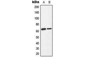 Western blot analysis of AMPK alpha 1/2 (pT183/172) expression in Jurkat Adriamycin-treated (A), K562 Adriamycin-treated (B) whole cell lysates. (PRKAA1/PRKAA2 antibody  (pSer172, pSer183))