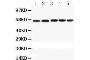 Western Blotting (WB) image for anti-Caspase 8 (CASP8) (AA 388-480) antibody (ABIN3042601) (Caspase 8 antibody  (AA 388-480))
