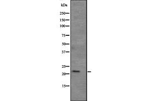 Western blot analysis of APR3 expression in human kidney tissue lysate ,The lane on the left is treated with the antigen-specific peptide. (ATRAID antibody  (Internal Region))