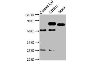 Immunoprecipitating CDH11 in SH-SY5Y whole cell lysate Lane 1: Rabbit control IgG instead of ABIN7146201 in SH-SY5Y whole cell lysate. (OB Cadherin antibody  (AA 637-796))