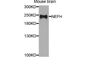 Western blot analysis of extracts of mouse brain cells, using NEFH antibody. (NEFH antibody)