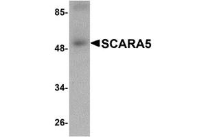 Western Blotting (WB) image for anti-Scavenger Receptor Class A, Member 5 (SCARA5) (C-Term) antibody (ABIN1030645) (SCARA5 antibody  (C-Term))