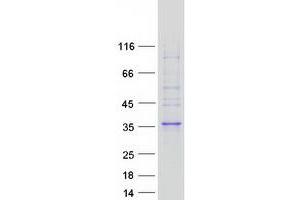 Family with Sequence Similarity 78, Member A (FAM78A) protein (Myc-DYKDDDDK Tag)