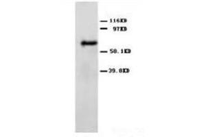 Western blot analysis of rat brain tissue lysis using ANG2 antibody (Angiopoietin 2 antibody  (C-Term))
