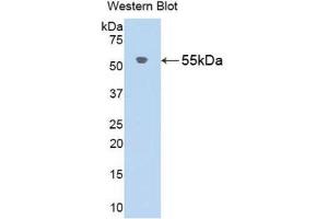 Western Blotting (WB) image for anti-Angiotensinogen (serpin Peptidase Inhibitor, Clade A, Member 8) (AGT) (AA 25-477) antibody (ABIN5661971)