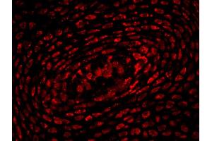 Formalin-fixed and paraffin-embedded mouse embryo labeled with Anti-HOXA10 Polyclonal Antibody, Unconjugated (ABIN723725) 1:200, overnight at 4 °C, The secondary antibody was Goat Anti-Rabbit IgG,Cy3 conjugated used at 1:200 dilution for 40 minutes at 37 °C. (HOXA10 antibody  (AA 311-410))
