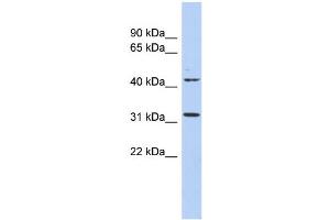 WB Suggested Anti-METTL6 Antibody Titration:  0.