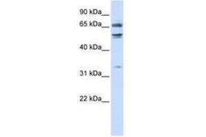 Image no. 1 for anti-Mediator Complex Subunit 26 (MED26) (N-Term) antibody (ABIN6742775) (MED26 antibody  (N-Term))